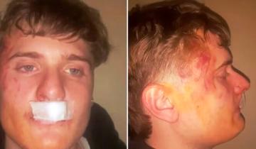 Imagen de La Provincia: otro joven fue víctima de un brutal ataque de un grupo rugbiers durante una fiesta
