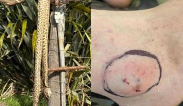 Imagen de Ataque de yarará en General Lavalle: un hombre permanece internado y vecinos se organizan ante la falta de suero