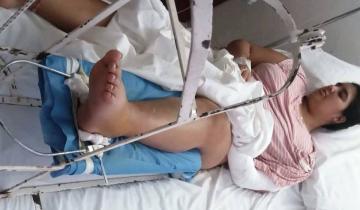 Imagen de Castelli: la familia de la adolescente atropellada en la Ruta 2 pide ayuda para solventar una operación urgente
