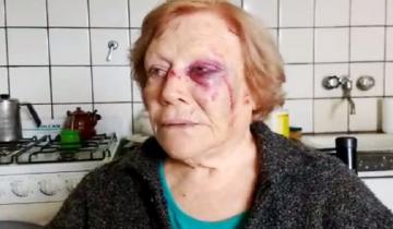 Imagen de Brutal agresión a una jubilada de 84 años en Balcarce: le robaron 20.000 pesos
