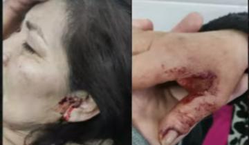 Imagen de Villa Gesell: entró a robar a un comercio, la dueña la descubrió e intentó apuñalarla para que no la denuncie