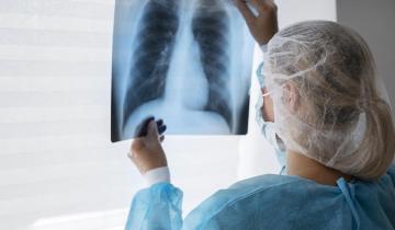 Imagen de Tuberculosis: alerta por el gran incremento de casos entre 2020 y el 2025
